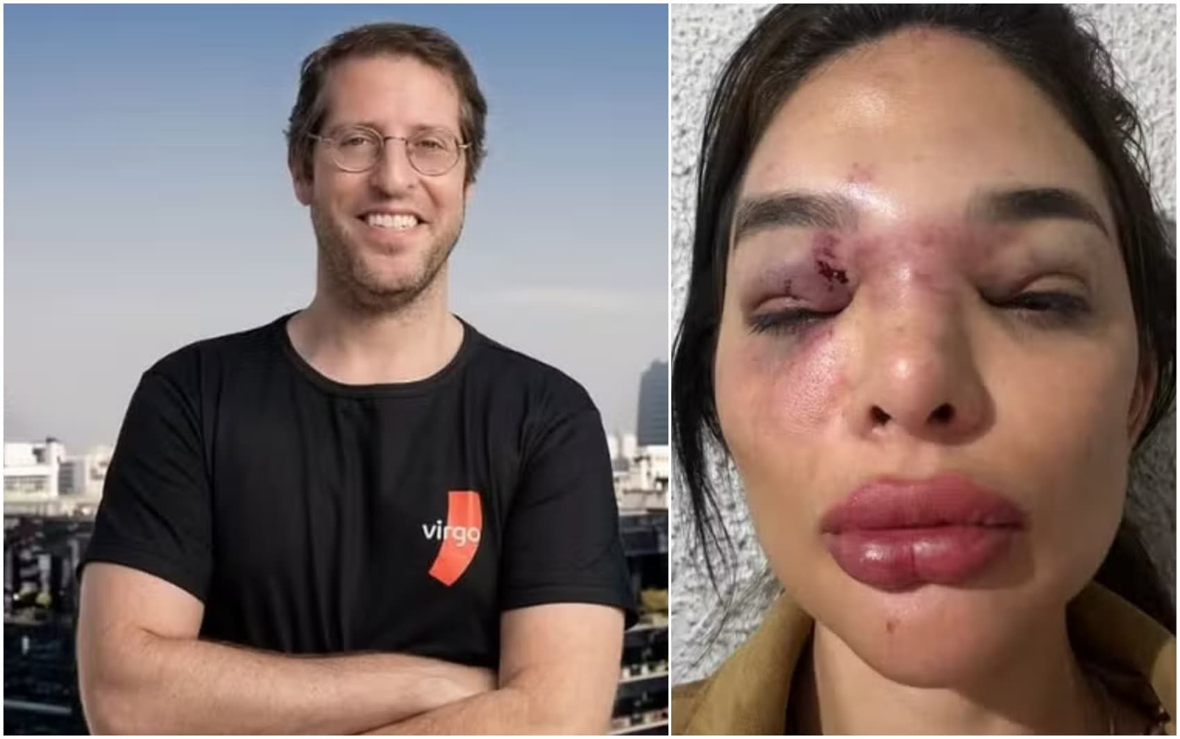 Ivo Kos é preso por agredir ex-mulher e revela histórico de violência