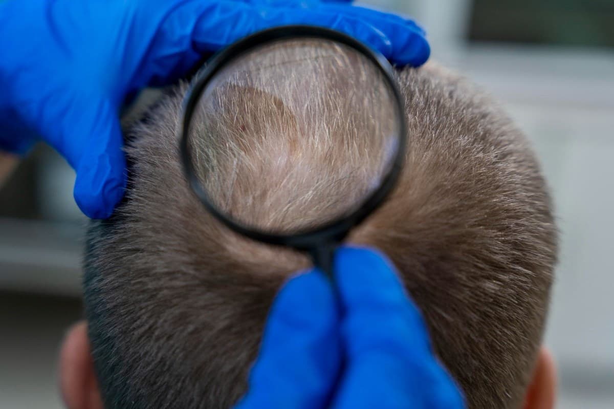 Estudo revela novo mecanismo por trás do crescimento do cabelo