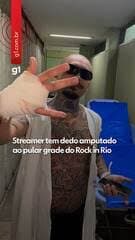 Streamer perde dedo em incidente e reflete sobre sua escolha