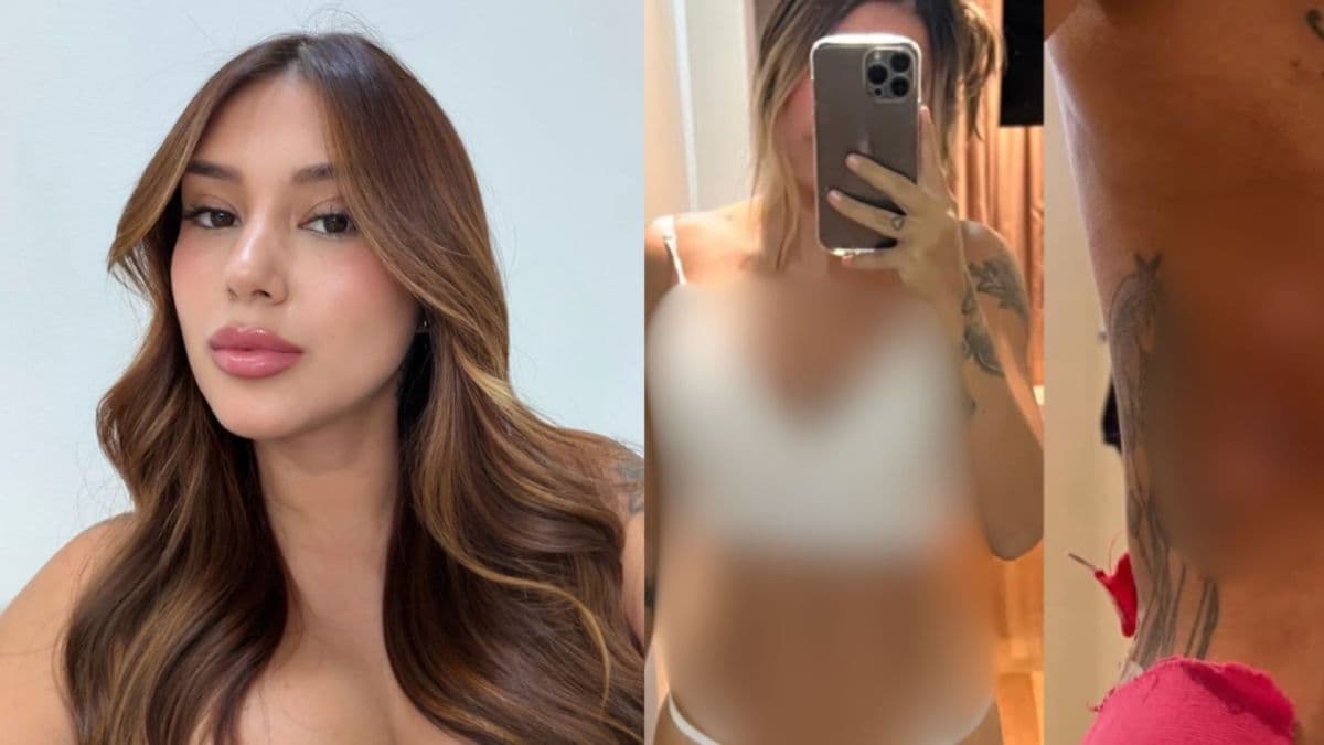 Mariana Tavares denuncia complicações após cirurgias estéticas