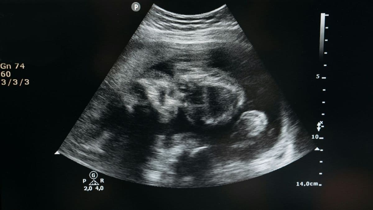 TJRS anula júri de mulher acusada de aborto sem provas concretas