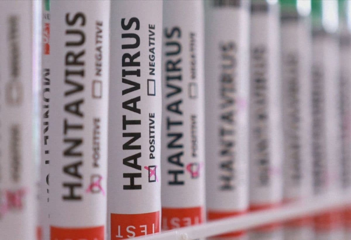 Monitoramento de Pacientes com Hantavírus nos EUA