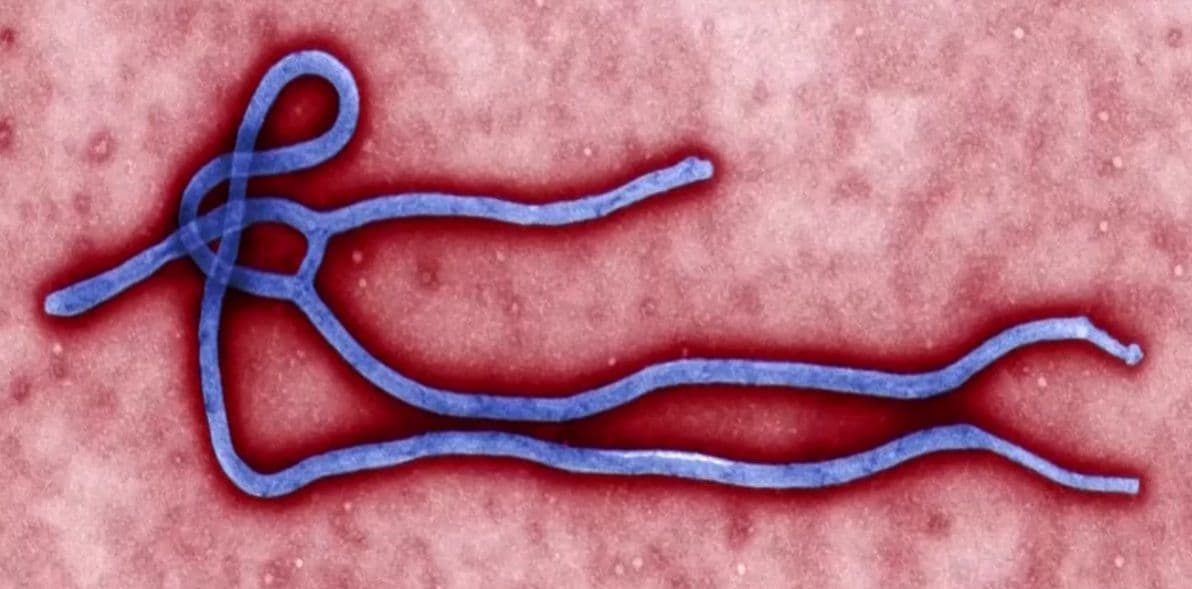Ebola no Congo: 999 mortes e falta de vacinas para cepa Bundibugyo