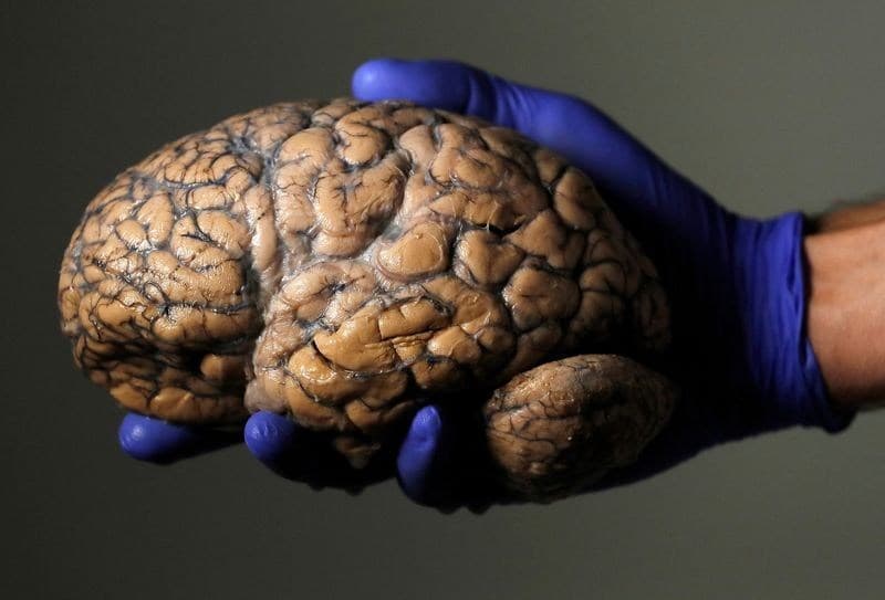 Estudo revela como cérebros antigos resistem à decomposição