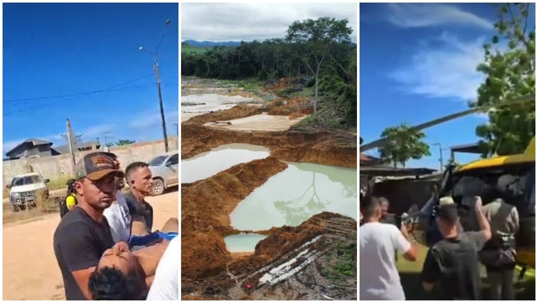 Deputado acusa agentes do ICMBio de tiros em crianças no Pará
