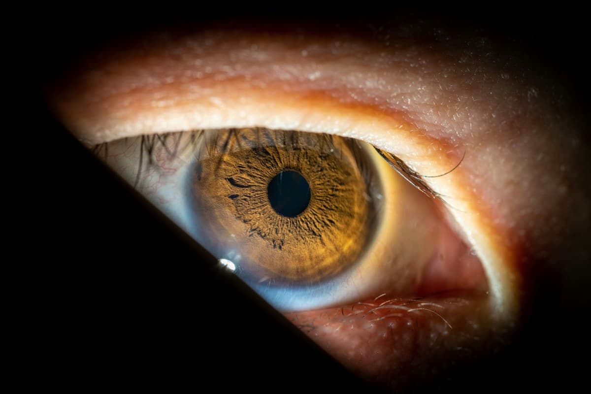 Novo tratamento para glaucoma e catarata será implantado no SUS