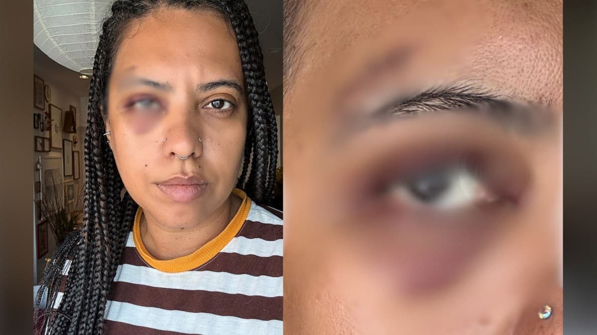 Agressão a influenciadora marca 20 anos da Lei Maria da Penha