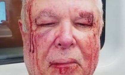 Idoso é agredido em Copacabana por motivações políticas